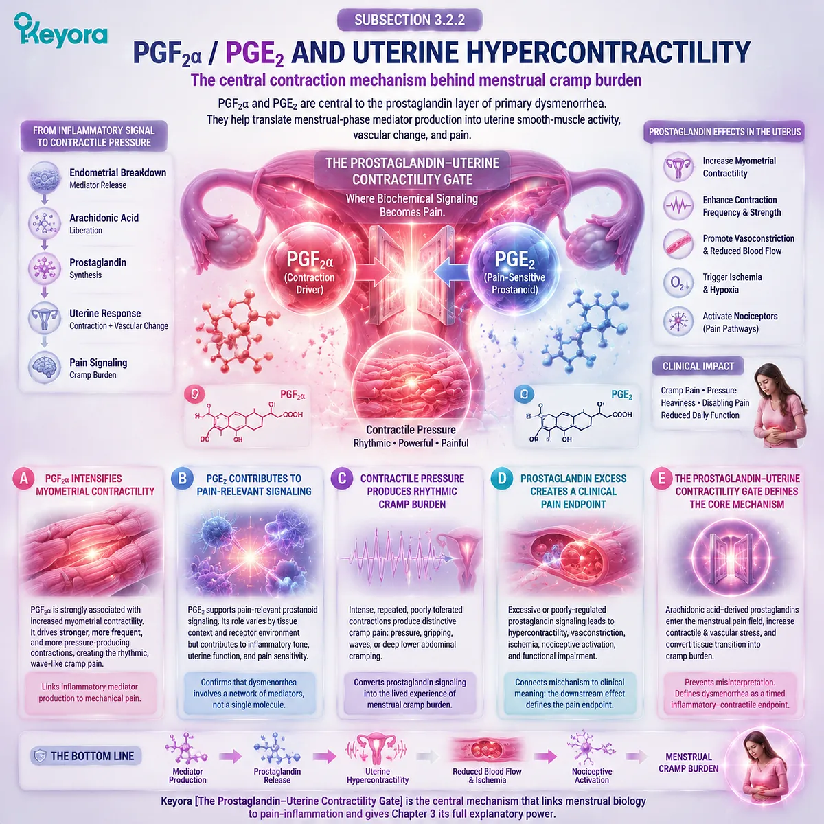 Dysmenorrhea PGF2α PGE2 prostaglandins drive uterine hypercontractility, ischemic menstrual pain and cramp rhythm via Keyora Prostaglandin-Uterine Contractility Gate Dysmenorrhea PGF2α PGE2 prostaglandins drive uterine hypercontractility, ischemic menstrual pain and cramp rhythm via Keyora Prostaglandin-Uterine Contractility Gate
