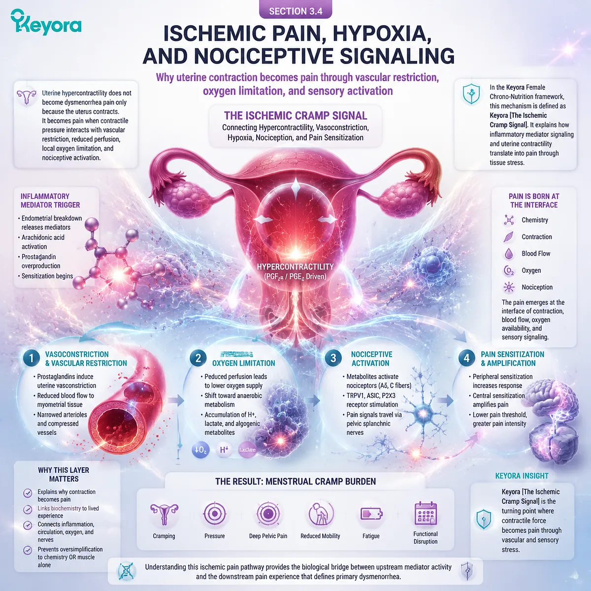 Dysmenorrhea ischemic pain uterine hypercontractility vasoconstriction hypoxia nociceptive signaling prostaglandins Keyora Ischemic Cramp Signal Dysmenorrhea ischemic pain uterine hypercontractility vasoconstriction hypoxia nociceptive signaling prostaglandins Keyora Ischemic Cramp Signal