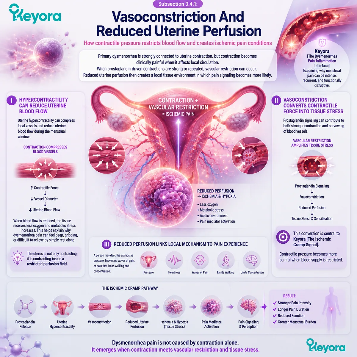 Dysmenorrhea uterine hypercontractility vasoconstriction reduced perfusion ischemic pain hypoxia prostaglandins Keyora Ischemic Cramp Signal interface Dysmenorrhea uterine hypercontractility vasoconstriction reduced perfusion ischemic pain hypoxia prostaglandins Keyora Ischemic Cramp Signal interface