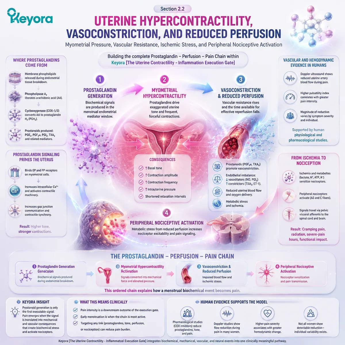 Primary dysmenorrhea pain pathway showing uterine hypercontractility, vasoconstriction, reduced perfusion, ischemic stress, and nociceptive activation through Keyora Uterine Contractility - Inflammation Execution Gate. Primary dysmenorrhea pain pathway showing uterine hypercontractility, vasoconstriction, reduced perfusion, ischemic stress, and nociceptive activation through Keyora Uterine Contractility - Inflammation Execution Gate.