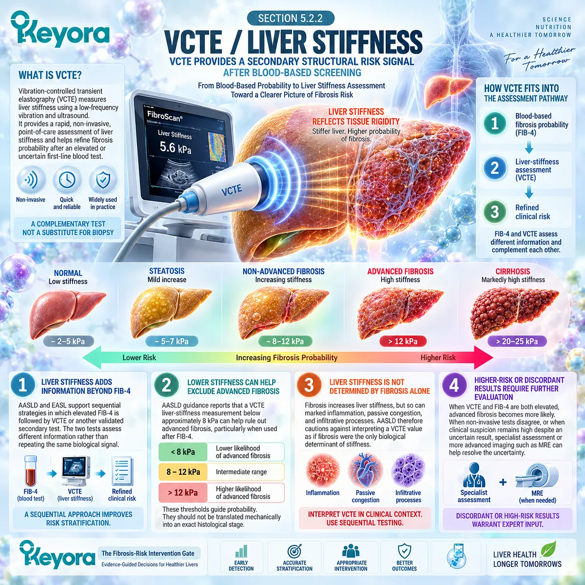 VCTE liver stiffness refines MASLD advanced fibrosis risk after FIB-4, linking secondary testing to Keyora The Fibrosis-Risk Intervention Gate. VCTE liver stiffness refines MASLD advanced fibrosis risk after FIB-4, linking secondary testing to Keyora The Fibrosis-Risk Intervention Gate.