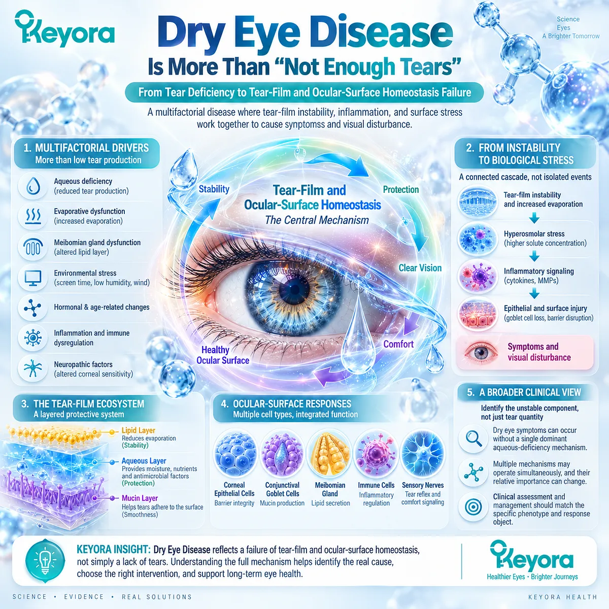 Dry eye disease links tear-film instability, evaporation, hyperosmolar stress and ocular-surface inflammation to homeostasis failure in the Keyora Tear-Film Homeostasis Matrix. Dry eye disease links tear-film instability, evaporation, hyperosmolar stress and ocular-surface inflammation to homeostasis failure in the Keyora Tear-Film Homeostasis Matrix.