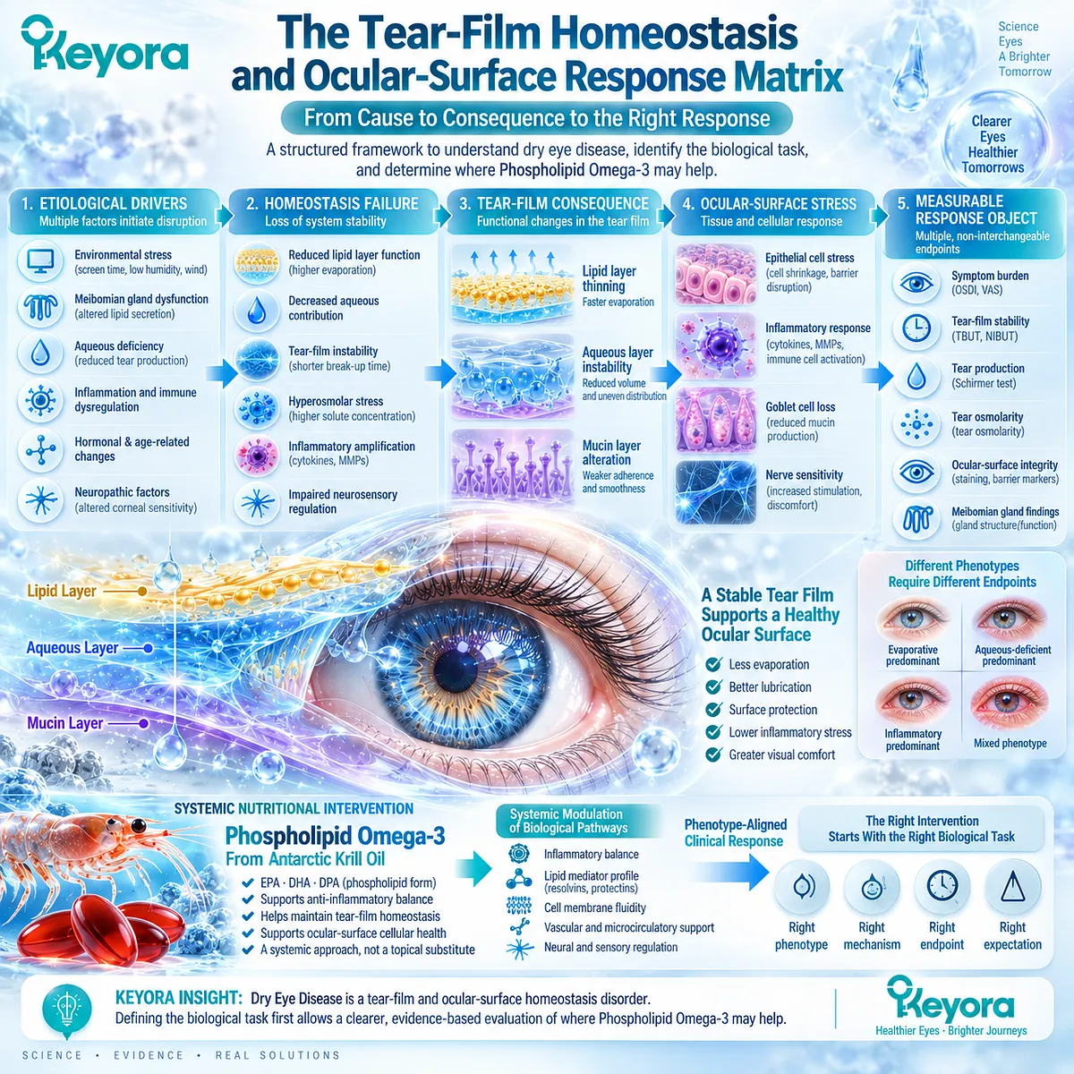 Dry eye support links tear-film instability, evaporation, osmotic stress and ocular-surface function through Keyora’s Tear-Film Homeostasis and Ocular-Surface Response Matrix. Dry eye support links tear-film instability, evaporation, osmotic stress and ocular-surface function through Keyora’s Tear-Film Homeostasis and Ocular-Surface Response Matrix.