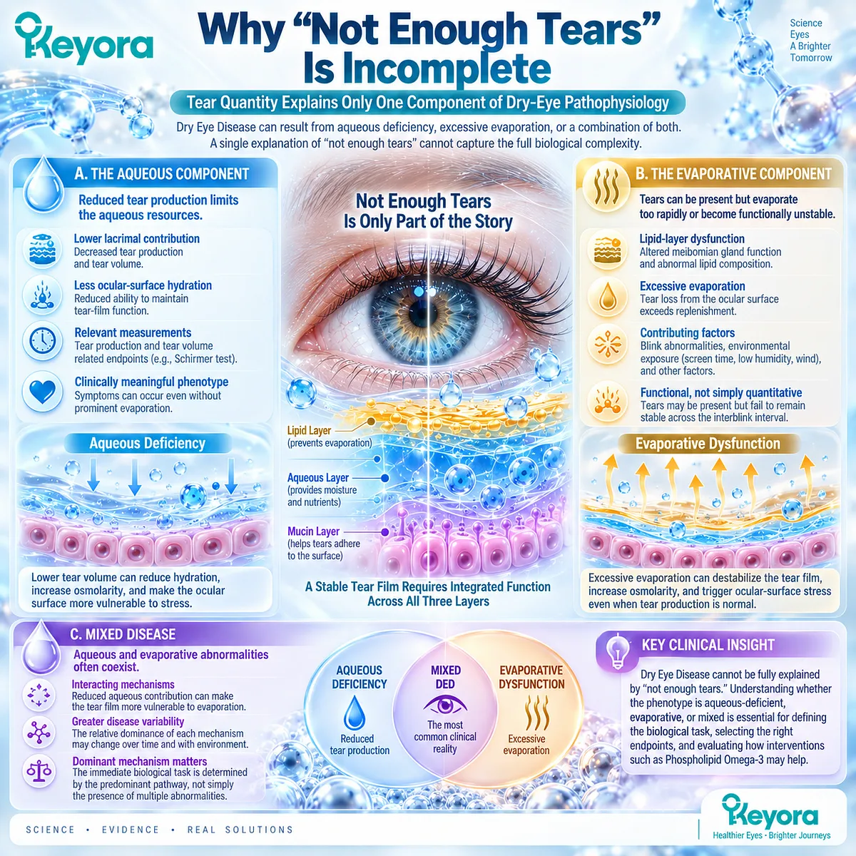 Dry eye disease can reflect aqueous deficiency, excessive tear evaporation or mixed tear-film instability, framed by Keyora’s Tear-Film Homeostasis and Ocular-Surface Response Matrix. Dry eye disease can reflect aqueous deficiency, excessive tear evaporation or mixed tear-film instability, framed by Keyora’s Tear-Film Homeostasis and Ocular-Surface Response Matrix.