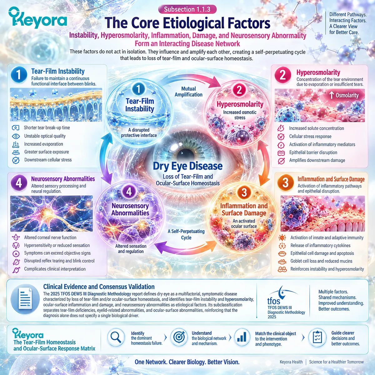 Dry eye disease links tear-film instability, hyperosmolarity, inflammation, surface damage and neurosensory dysfunction in Keyora’s Tear-Film Homeostasis and Ocular-Surface Response Matrix. Dry eye disease links tear-film instability, hyperosmolarity, inflammation, surface damage and neurosensory dysfunction in Keyora’s Tear-Film Homeostasis and Ocular-Surface Response Matrix.