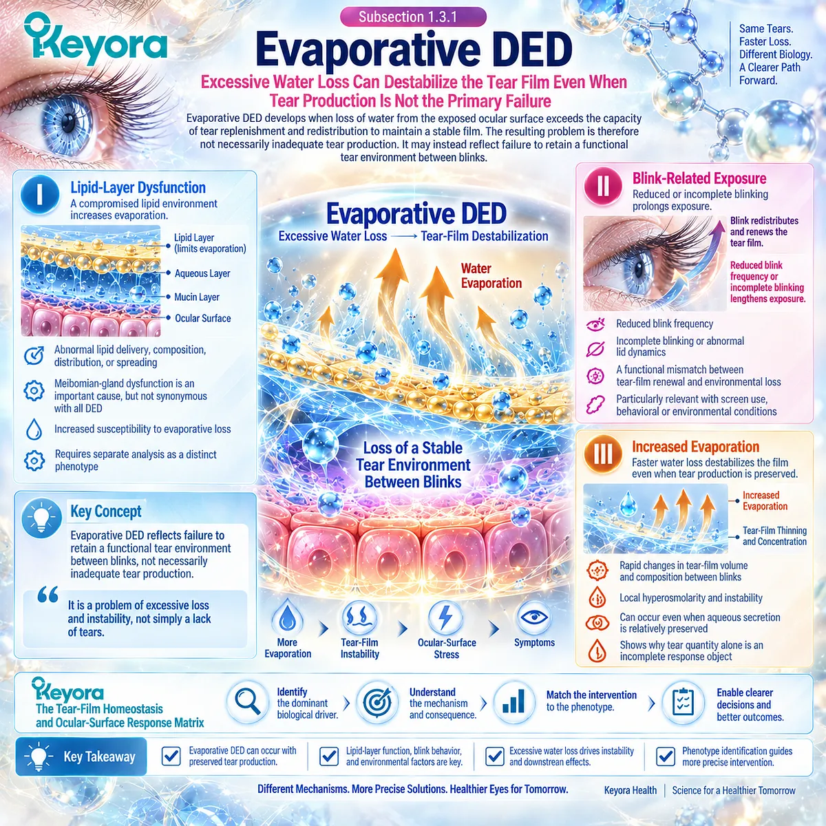 Evaporative dry eye links lipid-layer dysfunction, incomplete blinking and excessive tear evaporation to tear-film instability in Keyora’s Tear-Film Homeostasis and Ocular-Surface Response Matrix. Evaporative dry eye links lipid-layer dysfunction, incomplete blinking and excessive tear evaporation to tear-film instability in Keyora’s Tear-Film Homeostasis and Ocular-Surface Response Matrix.