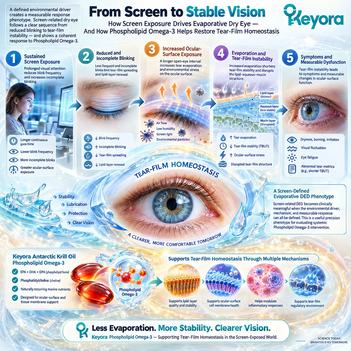 Screen-related dry eye links blink suppression and incomplete blinking to evaporative tear-film instability, mapped by Keyora’s Tear-Film Homeostasis and Ocular-Surface Response Matrix. Screen-related dry eye links blink suppression and incomplete blinking to evaporative tear-film instability, mapped by Keyora’s Tear-Film Homeostasis and Ocular-Surface Response Matrix.