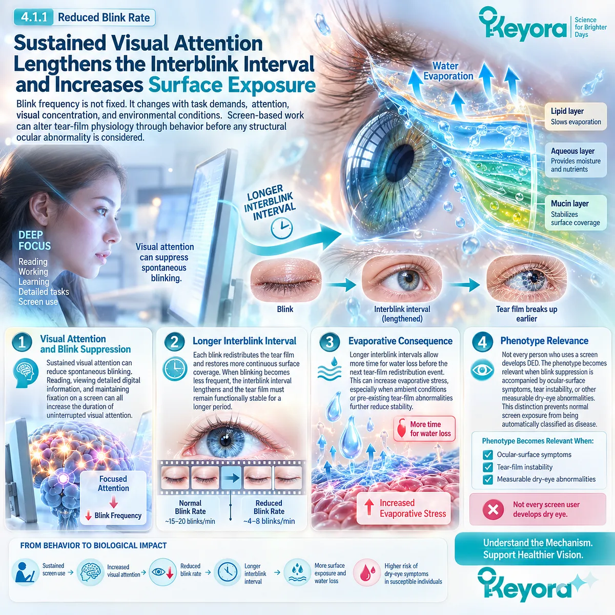 Screen-related dry eye links reduced blink rate and longer interblink intervals to ocular-surface evaporation and tear-film instability within Keyora’s Tear-Film Homeostasis Matrix. Screen-related dry eye links reduced blink rate and longer interblink intervals to ocular-surface evaporation and tear-film instability within Keyora’s Tear-Film Homeostasis Matrix.