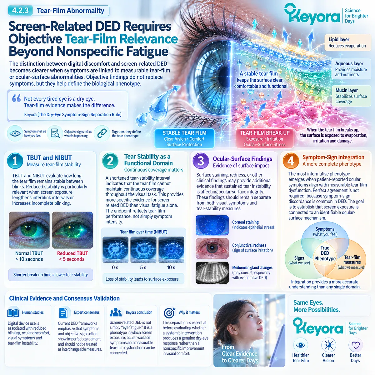 Screen-related dry eye links reduced TBUT or NIBUT and ocular-surface findings with symptoms, while Keyora’s Dry-Eye Symptom-Sign Separation Rule distinguishes DED from eye fatigue. Screen-related dry eye links reduced TBUT or NIBUT and ocular-surface findings with symptoms, while Keyora’s Dry-Eye Symptom-Sign Separation Rule distinguishes DED from eye fatigue.