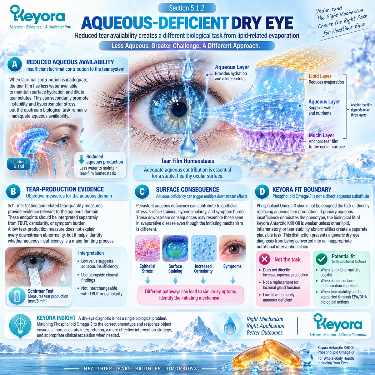 Aqueous-deficient dry eye links reduced tear production to hyperosmolarity and surface stress, defining the Phospholipid Omega-3 boundary in the Keyora Fit Rule. Aqueous-deficient dry eye links reduced tear production to hyperosmolarity and surface stress, defining the Phospholipid Omega-3 boundary in the Keyora Fit Rule.