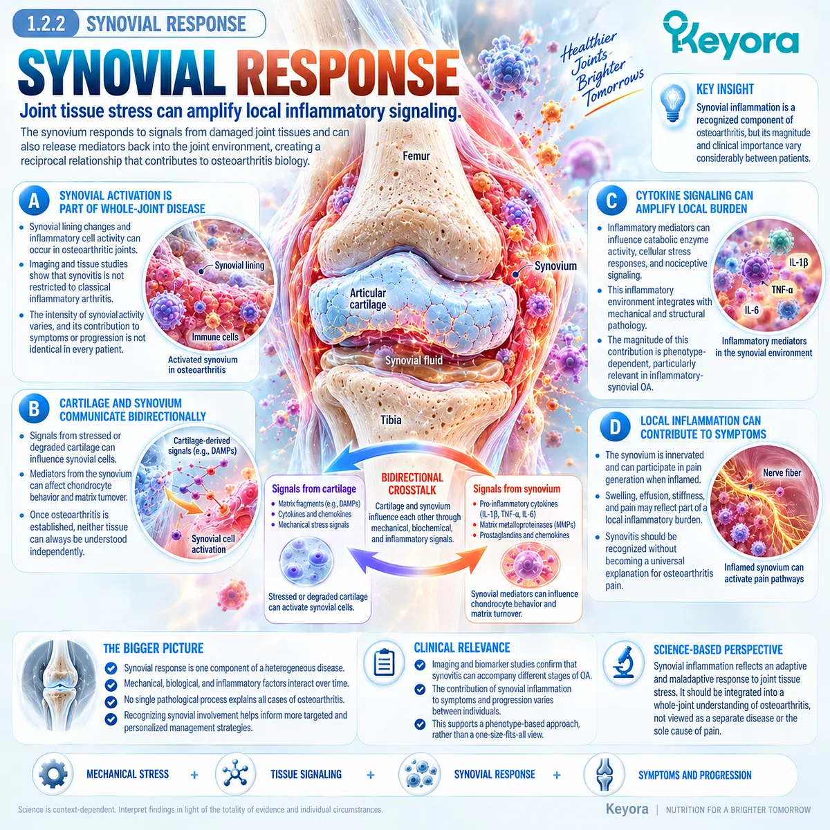 Osteoarthritis synovial inflammation links cartilage stress, cytokine signaling and nociceptive pathways with joint pain and stiffness in the Keyora whole-joint framework. Osteoarthritis synovial inflammation links cartilage stress, cytokine signaling and nociceptive pathways with joint pain and stiffness in the Keyora whole-joint framework.
