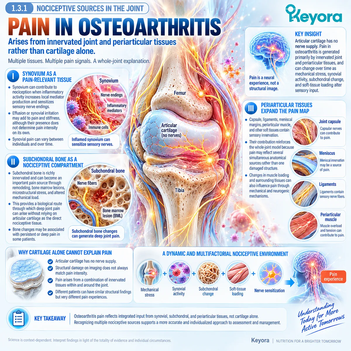 Osteoarthritis pain arises from synovium, subchondral bone and periarticular nociceptive tissues shaped by inflammation and mechanical stress in the Keyora whole-joint framework. Osteoarthritis pain arises from synovium, subchondral bone and periarticular nociceptive tissues shaped by inflammation and mechanical stress in the Keyora whole-joint framework.