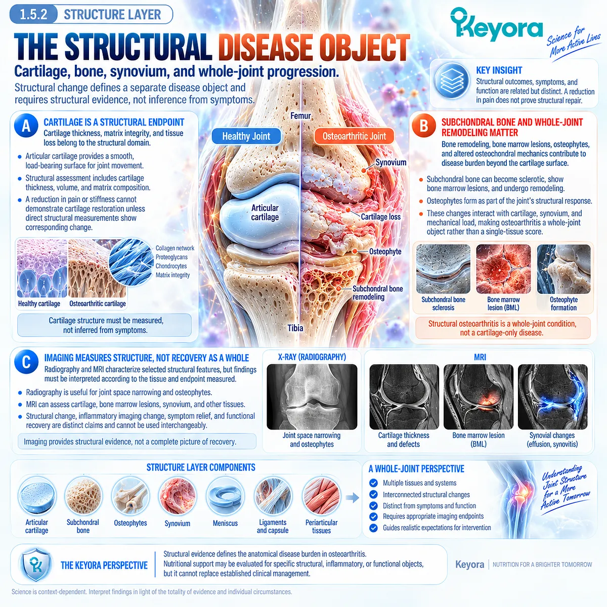 Osteoarthritis structural disease includes cartilage loss, subchondral bone remodeling and osteophytes, separated from symptom change in Keyora’s Joint Resolution-Structure-Function Matrix. Osteoarthritis structural disease includes cartilage loss, subchondral bone remodeling and osteophytes, separated from symptom change in Keyora’s Joint Resolution-Structure-Function Matrix.
