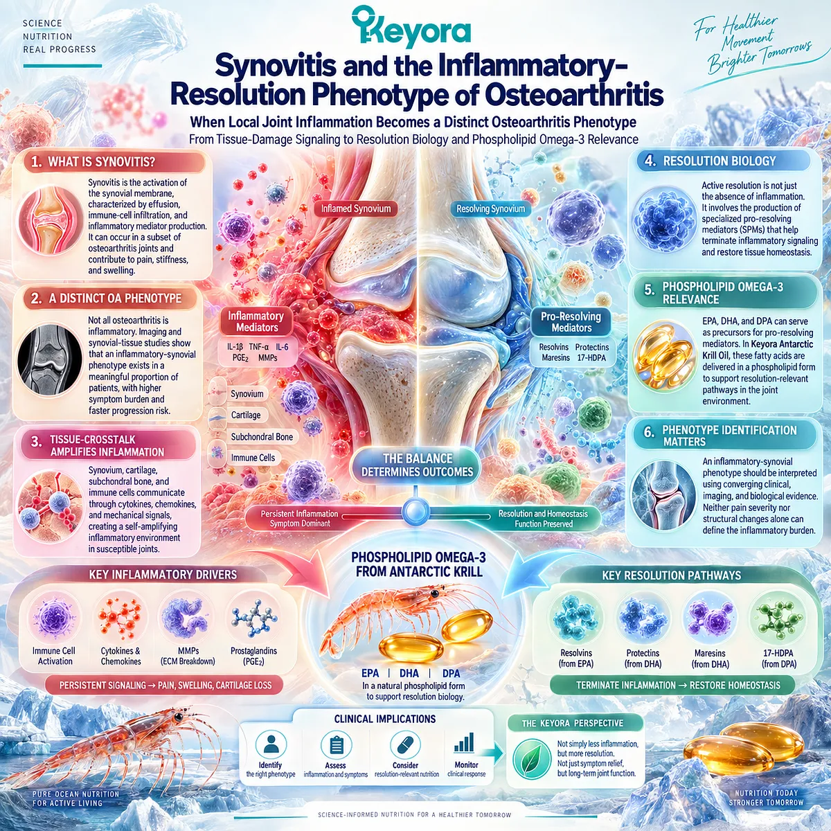 Osteoarthritis synovitis links inflammatory-resolution signaling with EPA, DHA and DPA pathways, framed by Keyora’s Joint Resolution-Structure-Function Matrix. Osteoarthritis synovitis links inflammatory-resolution signaling with EPA, DHA and DPA pathways, framed by Keyora’s Joint Resolution-Structure-Function Matrix.