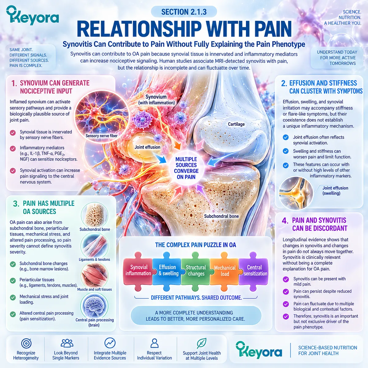 Osteoarthritis pain can reflect synovial inflammation and nociceptive signaling, but multiple joint pain sources create discordance mapped by the Keyora Resolution Layer. Osteoarthritis pain can reflect synovial inflammation and nociceptive signaling, but multiple joint pain sources create discordance mapped by the Keyora Resolution Layer.
