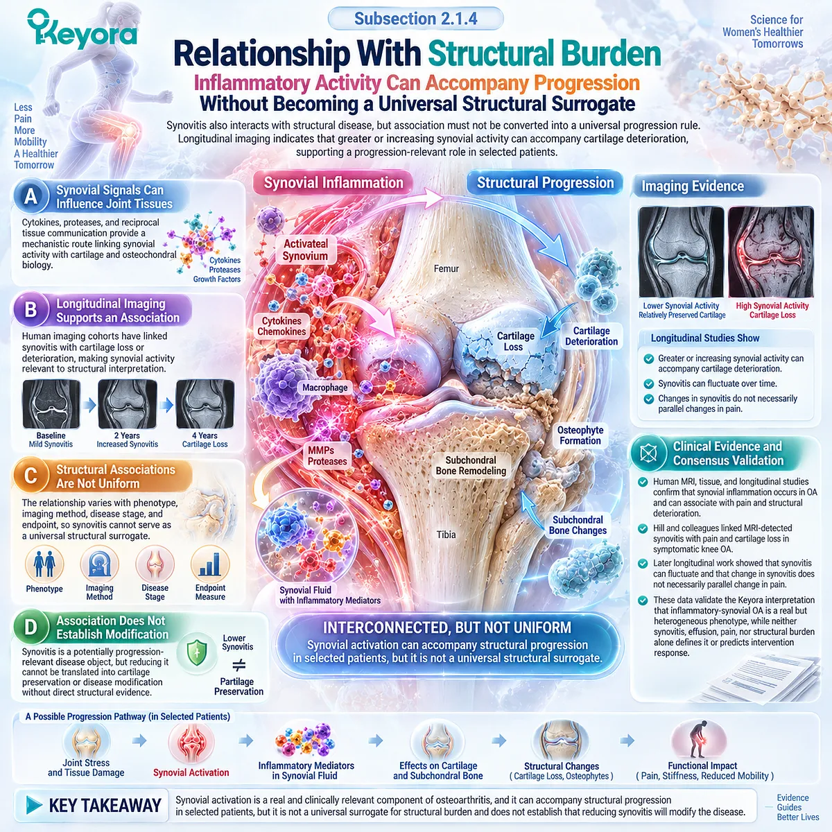 Osteoarthritis synovitis links inflammatory mediators with cartilage and osteochondral stress, but not universal progression, within the Keyora Resolution Layer. Osteoarthritis synovitis links inflammatory mediators with cartilage and osteochondral stress, but not universal progression, within the Keyora Resolution Layer.