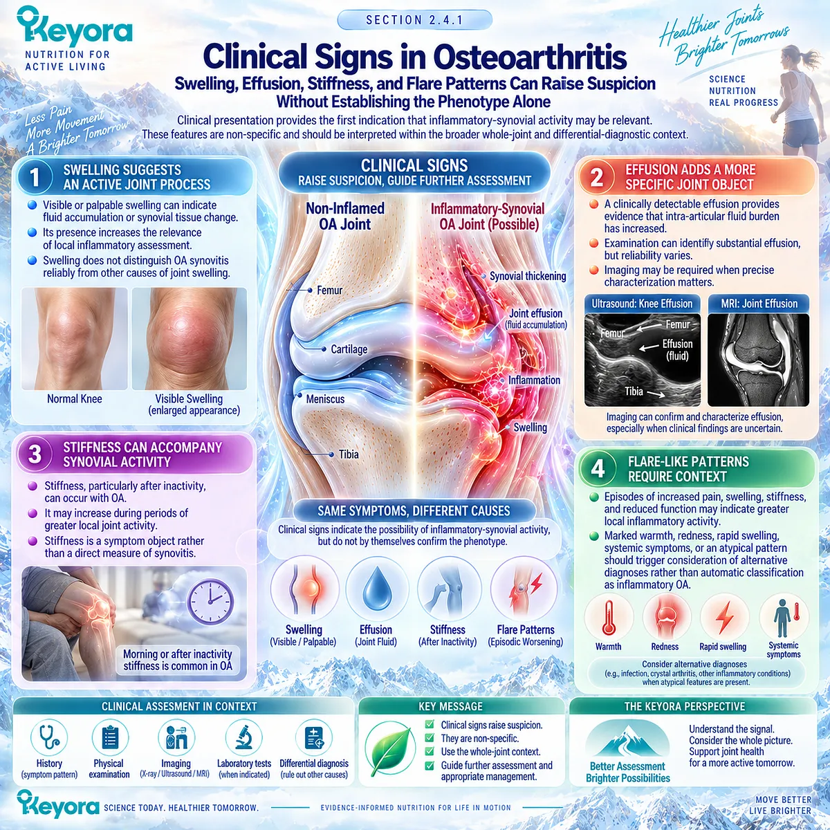 Inflammatory osteoarthritis signs such as swelling, effusion, stiffness and joint flares can signal synovial activity, interpreted through the Keyora Resolution Layer. Inflammatory osteoarthritis signs such as swelling, effusion, stiffness and joint flares can signal synovial activity, interpreted through the Keyora Resolution Layer.