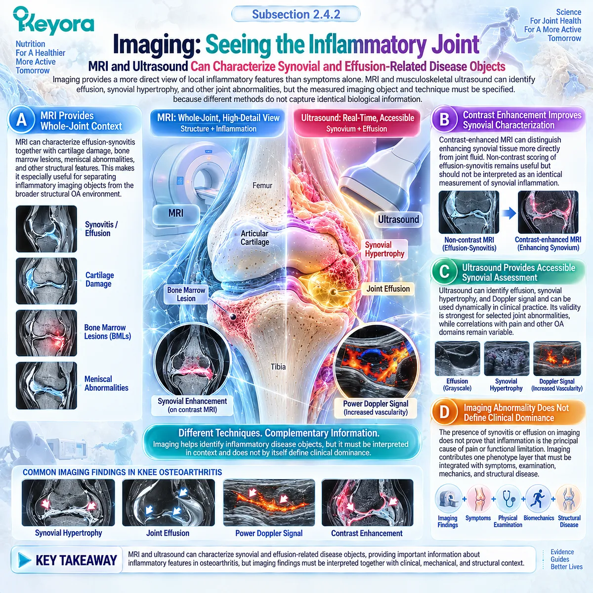 Inflammatory osteoarthritis imaging uses MRI and ultrasound to map synovitis, effusion and structural joint features within the Keyora Resolution Layer. Inflammatory osteoarthritis imaging uses MRI and ultrasound to map synovitis, effusion and structural joint features within the Keyora Resolution Layer.