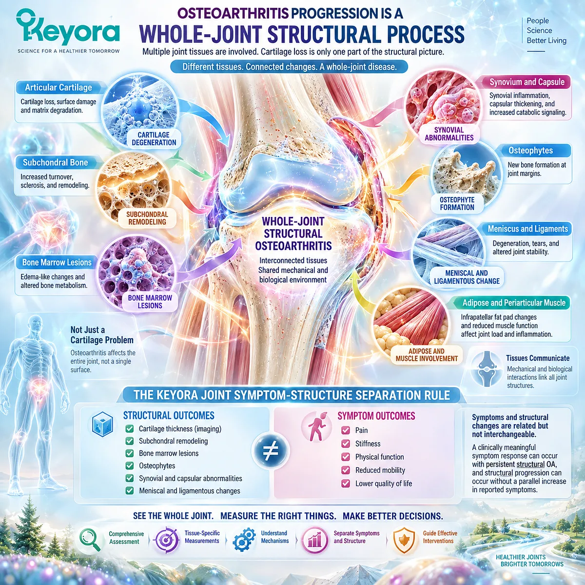 Osteoarthritis progression involves cartilage loss, subchondral bone remodeling and whole-joint tissue change, mapped by the Keyora Joint Symptom-Structure Separation Rule. Osteoarthritis progression involves cartilage loss, subchondral bone remodeling and whole-joint tissue change, mapped by the Keyora Joint Symptom-Structure Separation Rule.