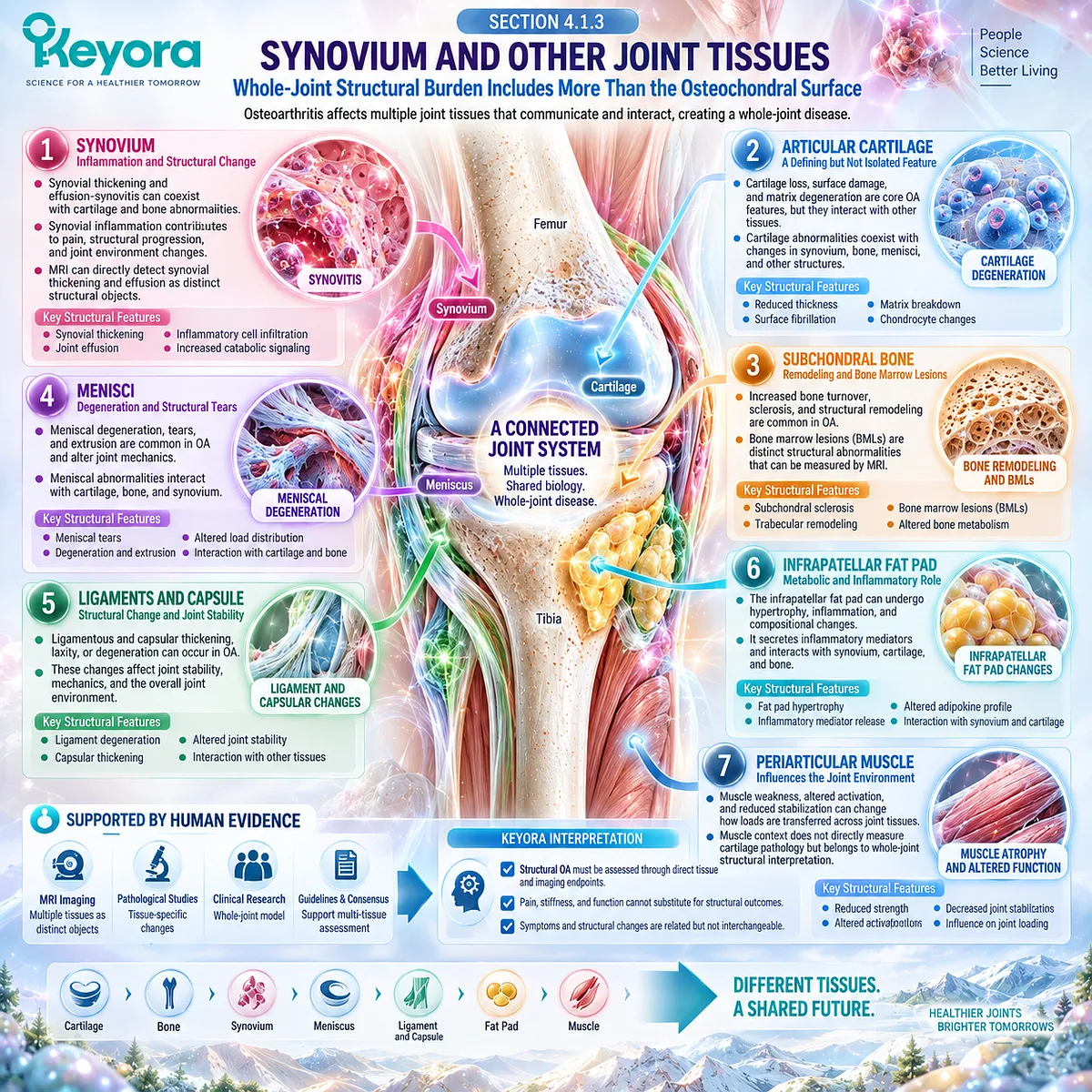 Osteoarthritis whole-joint pathology links synovium, menisci, ligaments, fat pad and muscle with mechanics and inflammation in the Keyora Joint Symptom-Structure Separation Rule. Osteoarthritis whole-joint pathology links synovium, menisci, ligaments, fat pad and muscle with mechanics and inflammation in the Keyora Joint Symptom-Structure Separation Rule.