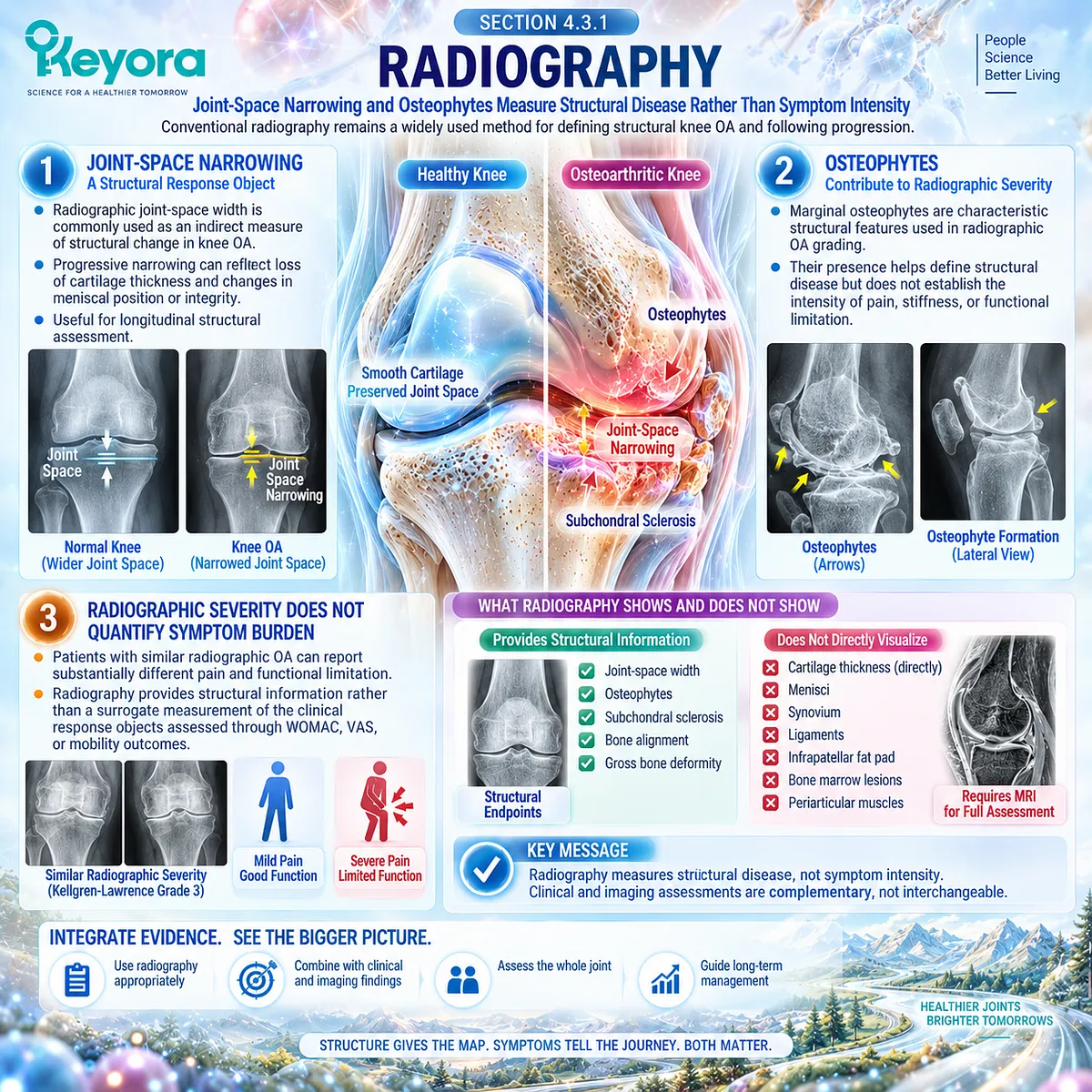Knee osteoarthritis radiography tracks joint-space narrowing and osteophytes as structural endpoints, separated from pain by the Keyora Joint Symptom-Structure Separation Rule. Knee osteoarthritis radiography tracks joint-space narrowing and osteophytes as structural endpoints, separated from pain by the Keyora Joint Symptom-Structure Separation Rule.