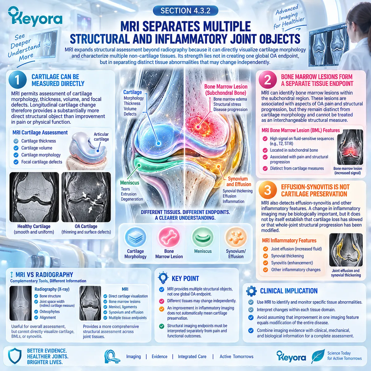 Osteoarthritis MRI measures cartilage loss, bone marrow lesions and effusion-synovitis as distinct joint endpoints in the Keyora Joint Symptom-Structure Separation Rule. Osteoarthritis MRI measures cartilage loss, bone marrow lesions and effusion-synovitis as distinct joint endpoints in the Keyora Joint Symptom-Structure Separation Rule.