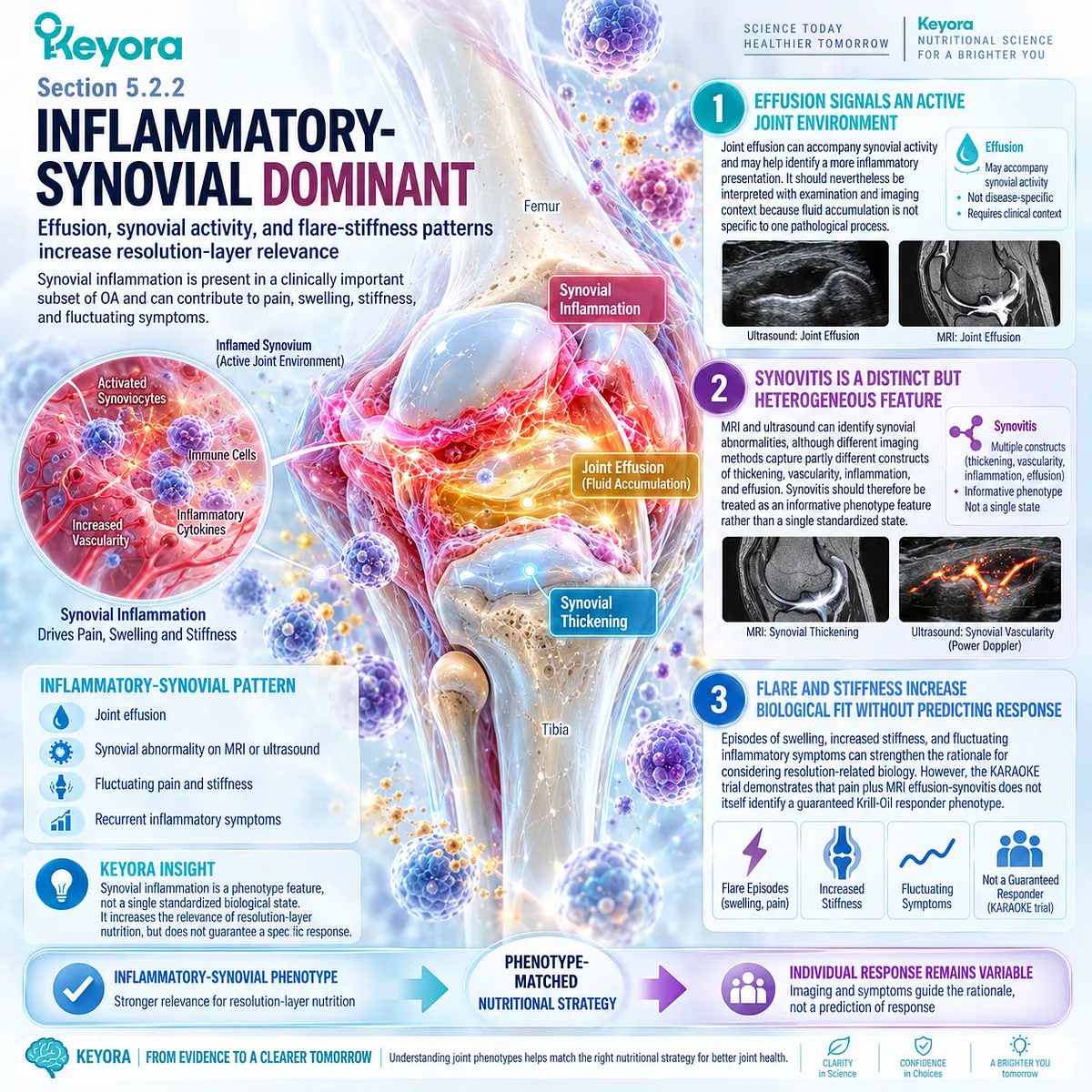 Osteoarthritis inflammatory phenotype links joint effusion, synovitis, and flare-stiffness patterns to resolution biology in Keyora Joint Phenotype-Dose-Endpoint Matching Rule. Osteoarthritis inflammatory phenotype links joint effusion, synovitis, and flare-stiffness patterns to resolution biology in Keyora Joint Phenotype-Dose-Endpoint Matching Rule.
